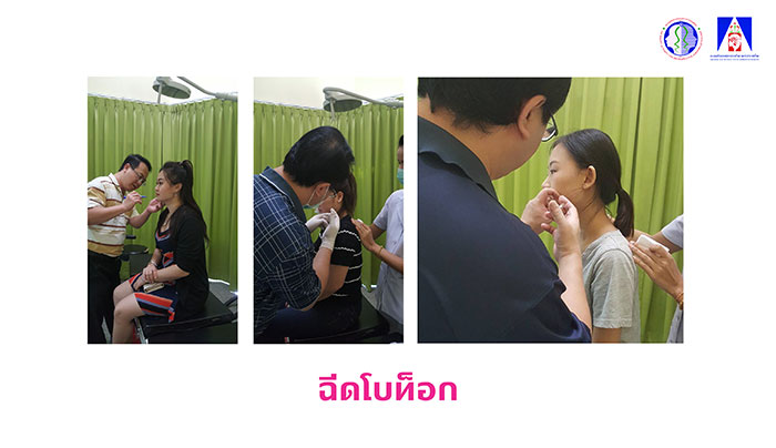 ฉีดโบท็อก ฉีดโบท็อก