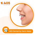 วิธีป้องกันปัญหาขากรรไกรหลังการจัดฟัน - คลินิกทันตกรรม405 เด็นทัล