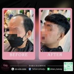 วิกผมปิดหัวล้าน - ร้านวิกผมติดกาวผู้ชาย ช่างองุ่น - Dara Hairwig